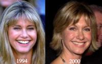 olivia newton john nose job